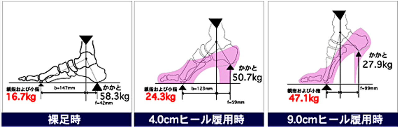 ハイヒール着用時に足底にかかる体重が前足部に集中する図説
