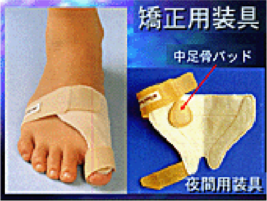 夜間用矯正用装具の画像
