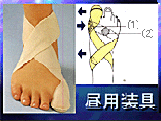 昼用矯正用装具の画像