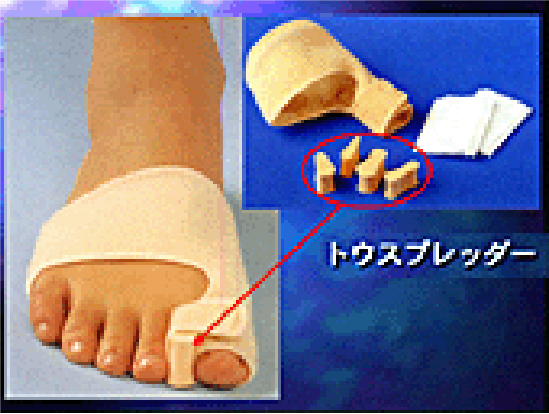 トウスプレッダーの画像