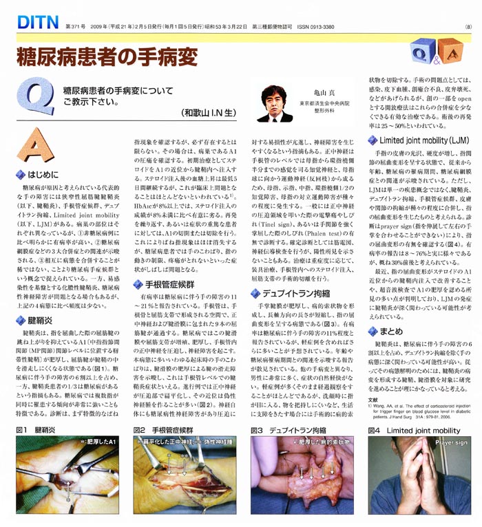 DITN(2009年2月号)に掲載された「糖尿病患者の手病変」に関する、亀山医師による記事の画像