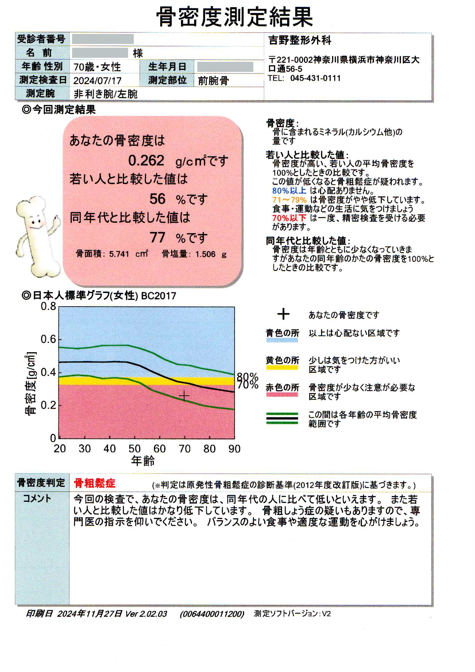 骨密度検査結果の画像