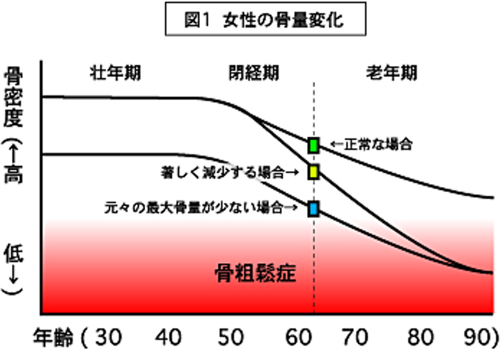 女性の骨量変化のグラフ
