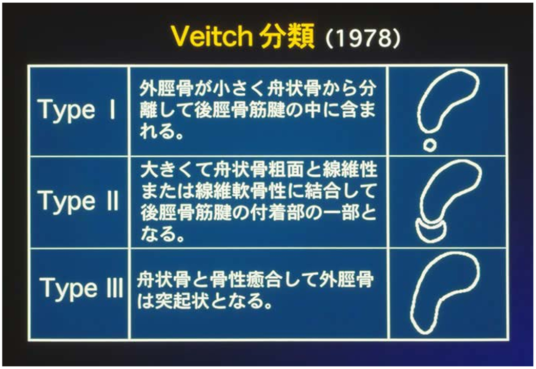 Veitch分類の表