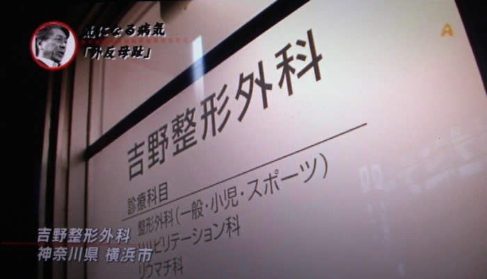 (番組キャプチャ)吉野整形外科の入り口が映される