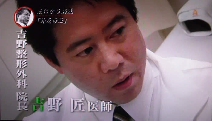 (番組キャプチャ)吉野院長の顔が映され、吉野整形外科 院長 吉野 匠医師のテロップ表示