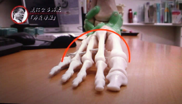 (番組キャプチャ)診察室の机の上に置いた足の骨の模型が正面からアップで映され、足の甲に赤い線でアーチが描かれる