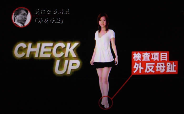 (番組キャプチャ)松島さんの全身が映され、テロップで、CHECK UP 検査項目外反母趾と表示される