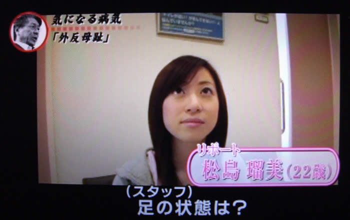 (番組キャプチャ)松島さんが吉野整形外科内の待合室に座っている。画面左下にリポート松島瑠美(22歳)と表示。テロップで(スタッフ)足の状態は?と表示