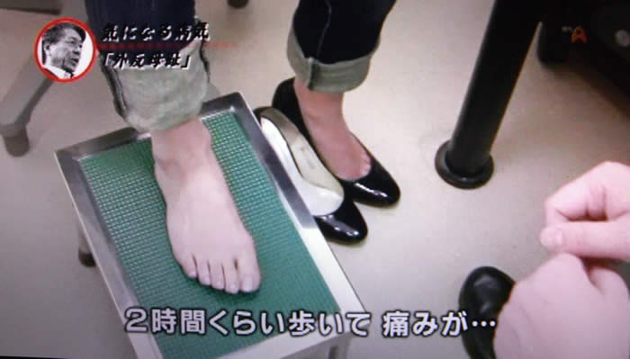 (番組キャプチャ)松島さんが答えながら靴を脱いで足を見せている。テロップは引き続き「2時間くらい歩いて 痛みが…」と表示