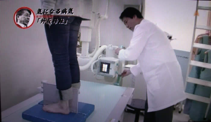 (番組キャプチャ)レントゲンの台に立った松島さんと、機械を操作する吉野院長