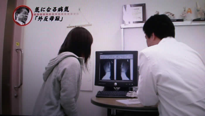 (番組キャプチャ)診察室で、パソコンに映った、足を上から撮影したレントゲン写真を見る吉野院長と松島さんの後ろ姿