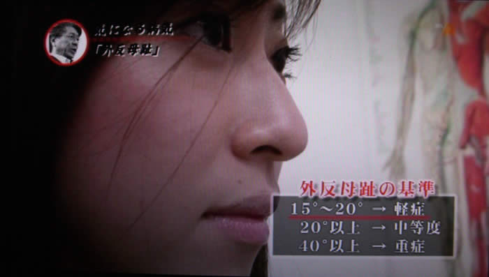 (番組キャプチャ)松島さんの横顔がアップで映される