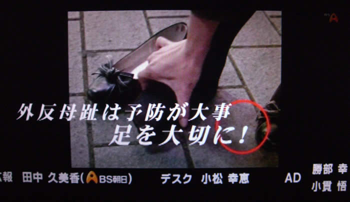 (番組キャプチャ)女性の足元とパンプスがアップで映される。その上からテロップが 外反母趾は予防が大事 足を大切に! と表示