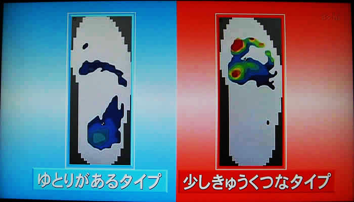 (番組キャプチャ)足底圧測定装置で測った、ゆとりがある靴と窮屈な靴の足裏の圧の分布を比較表示