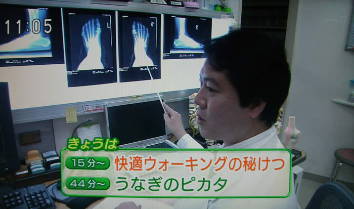 (番組キャプチャ)病院で患者さんにレントゲンの説明をしている吉野院長が映され、画面下部に番組の今日の内容が表示されている