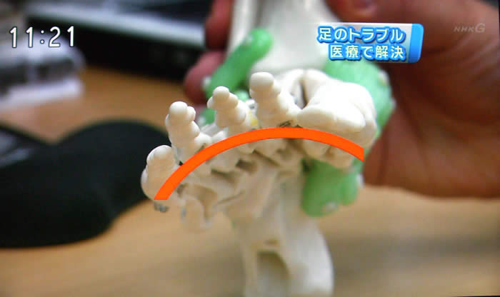 (番組キャプチャ)吉野院長が足の骨の模型を用いて横アーチの説明をしている。その足の骨の模型がアップで映し出される