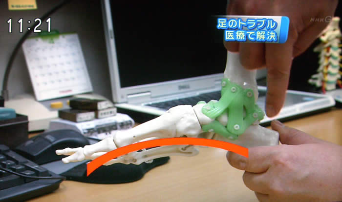 (番組キャプチャ)吉野院長が足の骨の模型を用いて縦アーチの説明をしている。その足の骨の模型がアップで映し出される