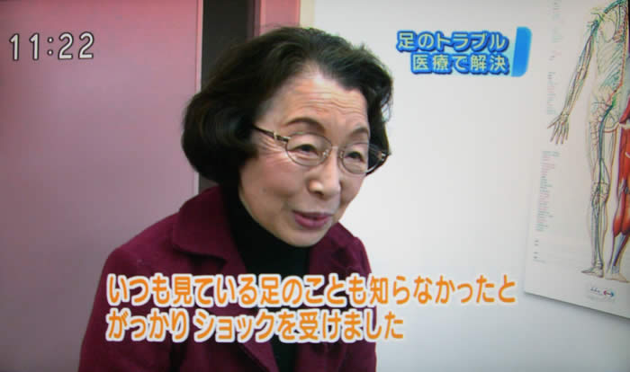 (番組キャプチャ)患者さんが吉野院長の説明を受けての感想を述べる続き「いつも見ている足のことも知らなかったとがっかり ショックを受けました」