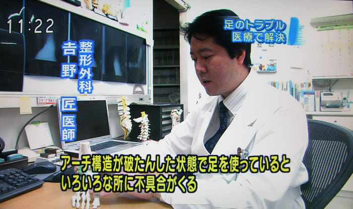 (番組キャプチャ)吉野院長の感想「アーチ構造が破たんした状態で足を使っているといろいろな所に不具合がくる」