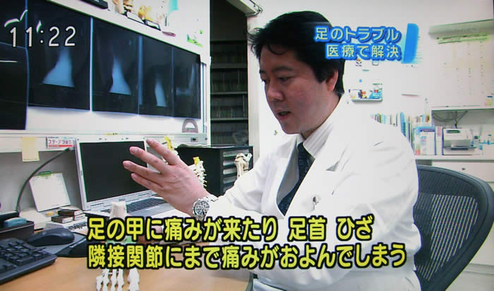 (番組キャプチャ)吉野院長の感想続き「足の甲に痛みが来たり 足首 ひざ 隣接関節にまで痛みがおよんでしまう」