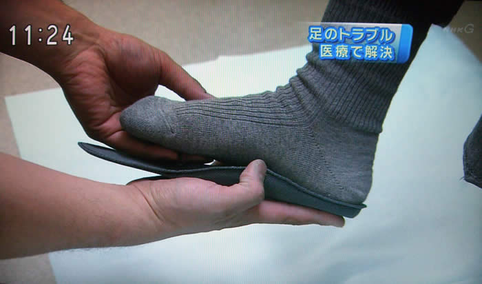 (番組キャプチャ)患者さんの足に合った中敷きを患者さんの足に当てている